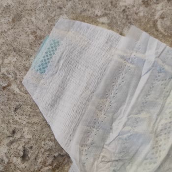 Kalite Düşüşüne Şaşırdım: Prima Bezi Sorunu
