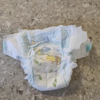 Kalite Düşüşüne Şaşırdım: Prima Bezi Sorunu