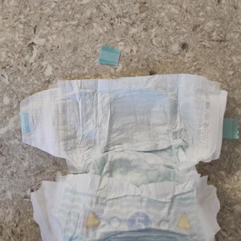 Kalite Düşüşüne Şaşırdım: Prima Bezi Sorunu