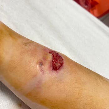 Simisso Otelin Otoparkında Doberman Köpek Dehşeti