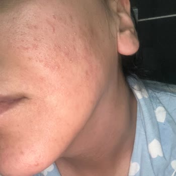 Gratis Aloe Vera Jeli Hayal Kırıklığı Yarattı