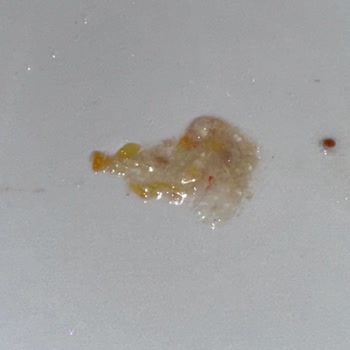 İbb Eyüpsultan Aşevi Yemeği Zehirledi