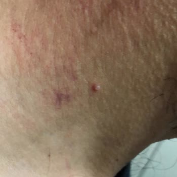 Osmaneli Mustafa Selahattin Çetintaş Devlet Hastanesi Hasta Haklarının Hiçe Sayılması