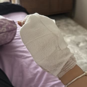 WMF Düdüklü Patladı, Göbeğim Yandı, 9 Aylık Hamileyim!