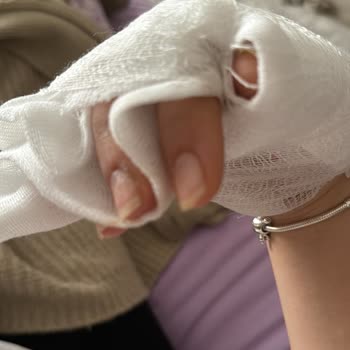 WMF Düdüklü Patladı, Göbeğim Yandı, 9 Aylık Hamileyim!