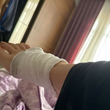 WMF Düdüklü Patladı, Göbeğim Yandı, 9 Aylık Hamileyim!