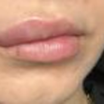 Hospitadent Yanlış Tedavi Süreci Eksik Bilgilendirme