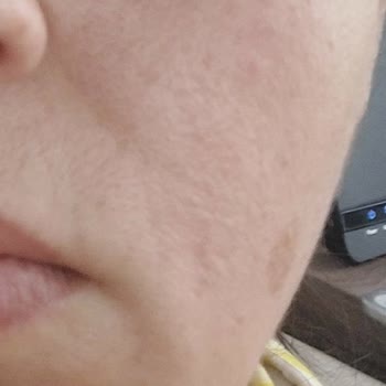 Loreal Hyaluron Uzmanı Cilt Dolgunlaştırıcı Arındırıcı Temizleme Jeli