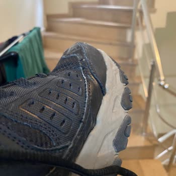 Skechers Ayakkabı Dayanaksızlığı Ve Müşteri Hizmetlerinin İlgisizliği