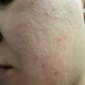 CeraVe Carave Vücut Kremi