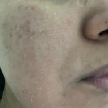 CeraVe Carave Vücut Kremi