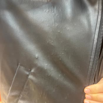 Zara Deri Ceket Hatası