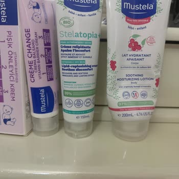 Mustela Kremleri Alerjiye Neden Oldu