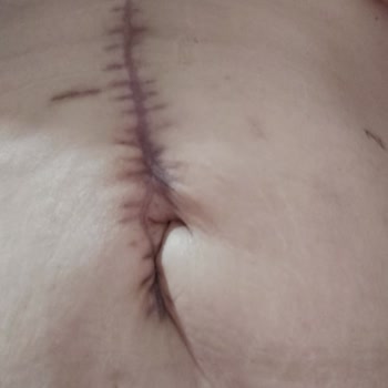 Özel Hürrem Sultan Hastanesi Özel Hastanede Yaşanan Ameliyat Sürecindeki Sorunlar