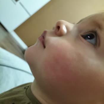 Dalin Islak Mendil Alerji