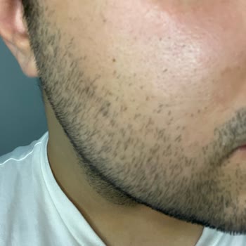 Revolution Beauty Revolution Kızarıklık Faciası