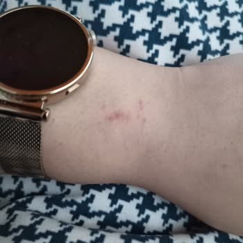 Huawei Watch Gt 4 Kordon Sorunu