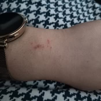 Huawei Watch Gt 4 Kordon Sorunu