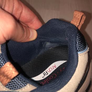 Skechers Ayakkabıda Şikayetim Var