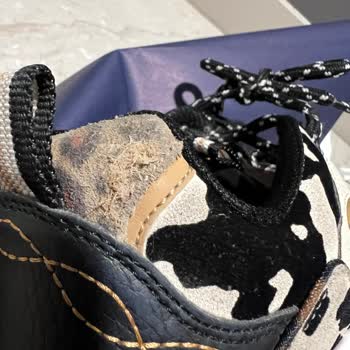 Skechers Ayakkabının Hatasını Kullanıcı Diyerek Önemsemediler.