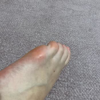 Birkenstock Rahat Etmek İçin Aldım Ayağım Mahvoldu