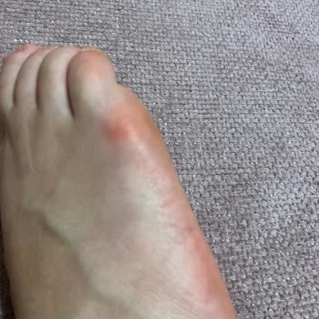 Birkenstock Rahat Etmek İçin Aldım Ayağım Mahvoldu