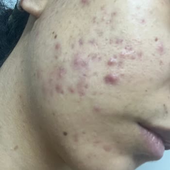 La Roche Posay Yüzümü Maf Etti