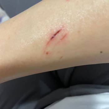 Koçtaş' Dan Aldığım Duşakabin Patladı, Yardımcı Olmuyorlar, Mağdurum