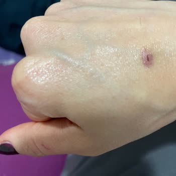 Koçtaş' Dan Aldığım Duşakabin Patladı, Yardımcı Olmuyorlar, Mağdurum