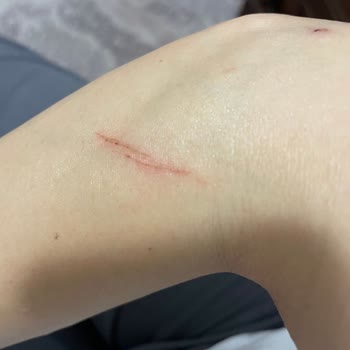 Koçtaş' Dan Aldığım Duşakabin Patladı, Yardımcı Olmuyorlar, Mağdurum