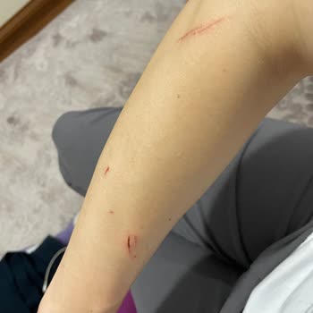 Koçtaş' Dan Aldığım Duşakabin Patladı, Yardımcı Olmuyorlar, Mağdurum