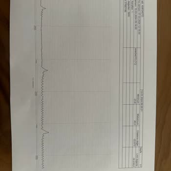 Bosch Marka Buzdolabı Servisin Verdiği Komik Cevaplar
