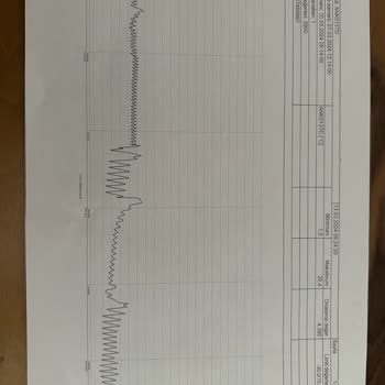 Bosch Marka Buzdolabı Servisin Verdiği Komik Cevaplar