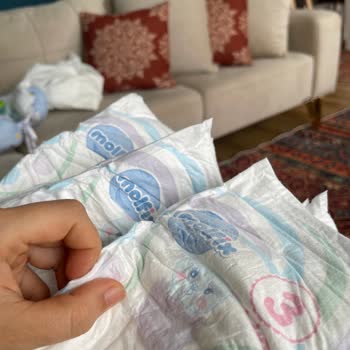 Molfix Bebek Bezi Sızdırıyor