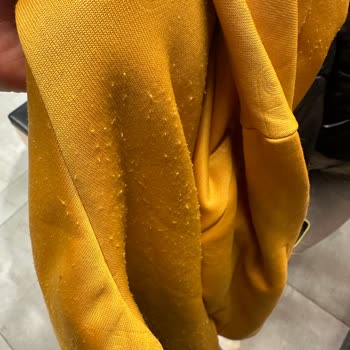 Adidas Özel Ürün Garanti Kabul Etmiyor