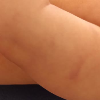 Kırşehir Eğitim ve Araştırma Hastanesi Çocuk Sağlığı Bölümünde Yaşanan Kan Alma Sorunu