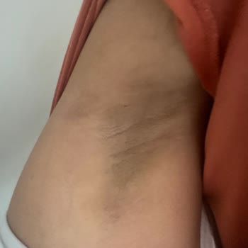 Vip Estetik Güzellik Vıp İstanbul Klinik Bartın Şubesi