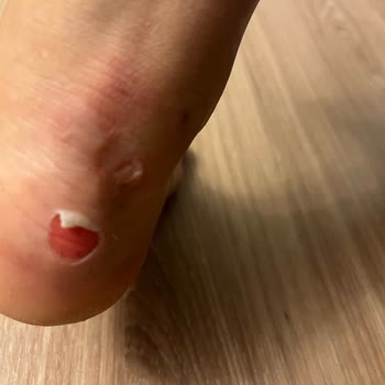 Zara Ayakkabı Rahatlığından Yoksun