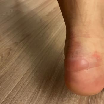 Zara Ayakkabı Rahatlığından Yoksun