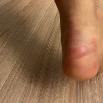 Zara Ayakkabı Rahatlığından Yoksun