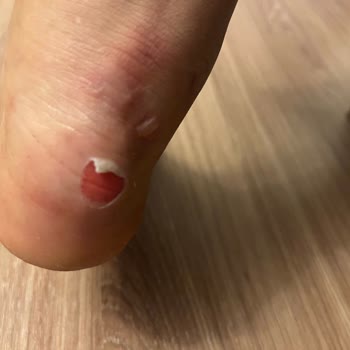 Zara Ayakkabı Rahatlığından Yoksun