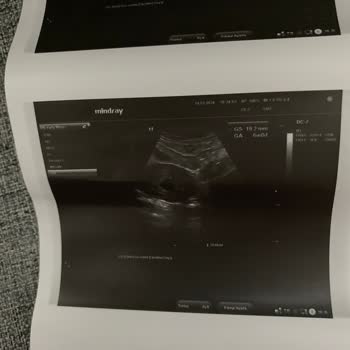 A Life Hospital Doktorun İlgisizliği Ve Bilgisizliği!