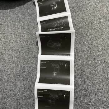 A Life Hospital Doktorun İlgisizliği Ve Bilgisizliği!