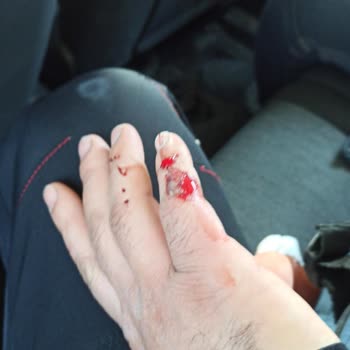 Smartmi Gorilla G3 Amortisör Sorunu