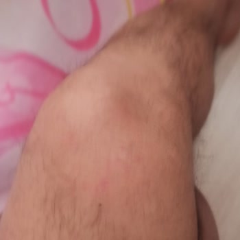 Smartmi Gorilla G3 Amortisör Sorunu