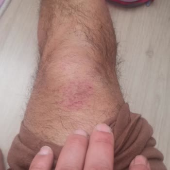 Smartmi Gorilla G3 Amortisör Sorunu