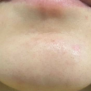 Maria LaRue Güzellik Salonu (Bursa) Düzgün Yapılmayan İşlemler Ve Sorumsuz Çalışanlar!