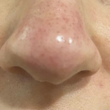 Maria LaRue Güzellik Salonu (Bursa) Düzgün Yapılmayan İşlemler Ve Sorumsuz Çalışanlar!