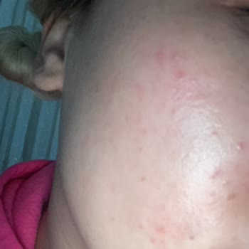 Braun Kişisel Bakım Ürünleri Braun Ürünleri Pişmanlık Yüzüm Mahvoldu