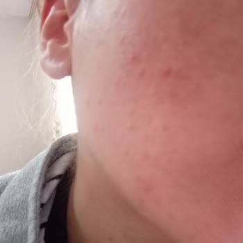 Newwell Micellar Water